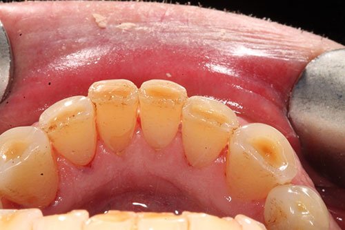 hygiene-1a